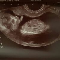 Nuevo! futuras mamis noviembre 2017 - 1