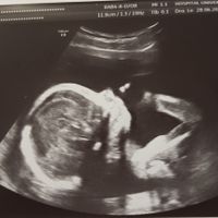 Nuevo! futuras mamis noviembre 2017 - 1