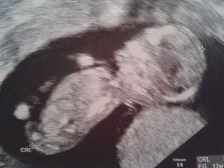 20150708 3 meses privado