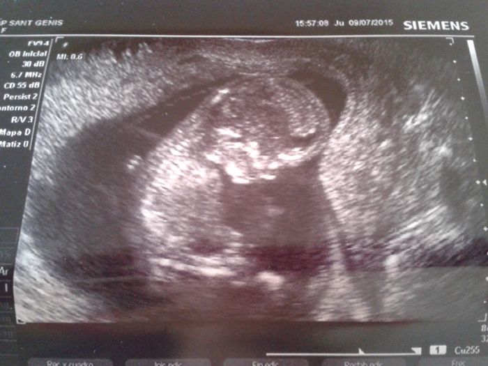 201507009 3 meses seg social