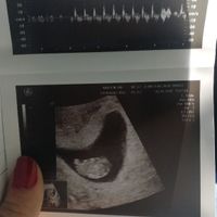 Futuras mamás Noviembre 2018! - 1