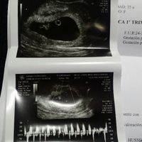 Mamis julio 2017 - 1