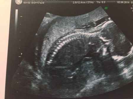 El consultorio de Lita para futuras mamis - 2