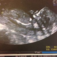 El consultorio de Lita para futuras mamis - 1