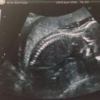 El consultorio de Lita para futuras mamis - 2
