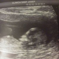 El consultorio de Lita para futuras mamis - 1