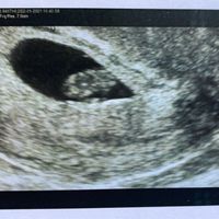 Futuras mamas septiembre 2021🤰🤱 - 1