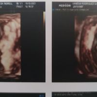 Futuras mamas septiembre 2021🤰🤱 - 1