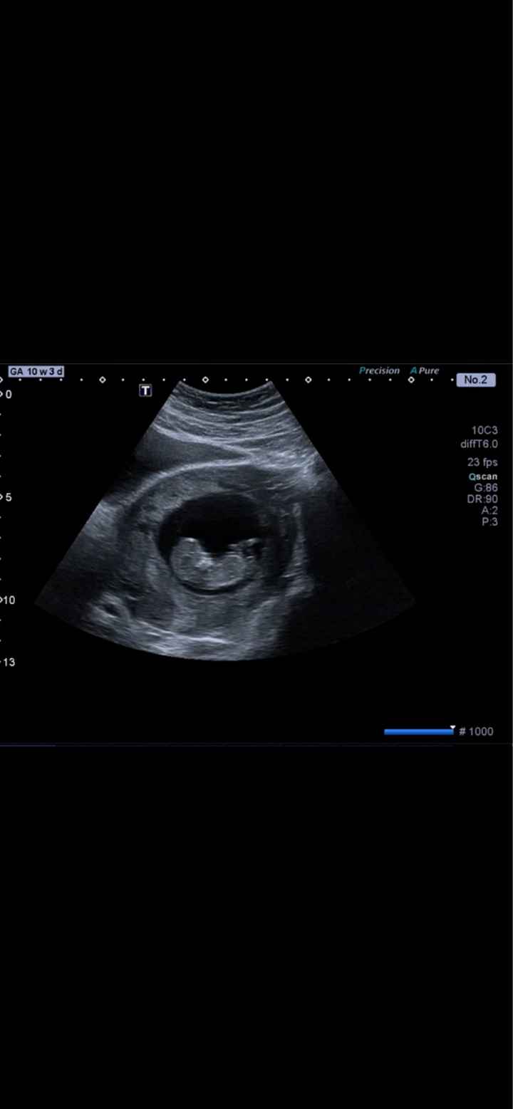 Futuras mamas octubre 2020 - 1