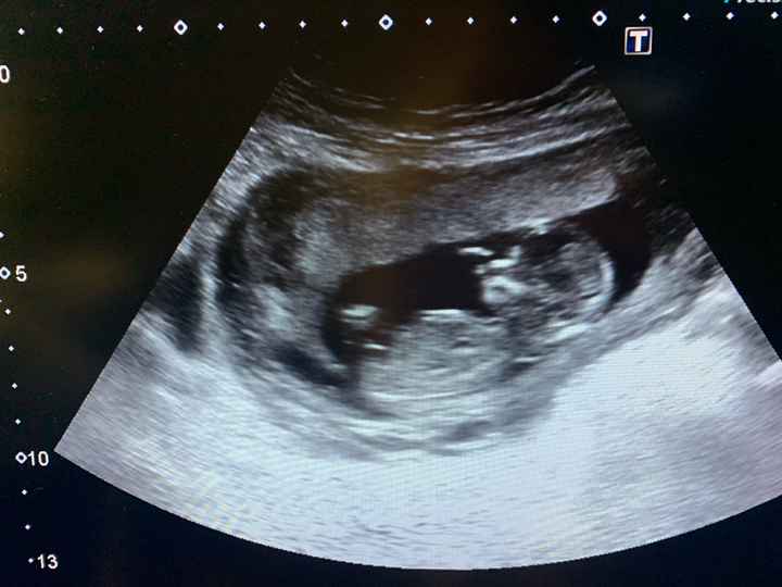 Futuras mamás Septiembre 2020 - 1