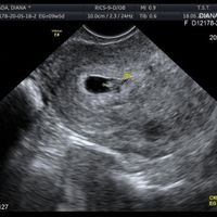 Futuras Mamis Enero 2021 - 1