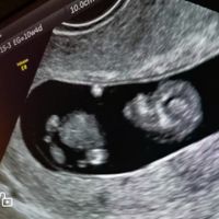 Futuras Mamis Enero 2021 - 1