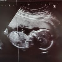 Futuras Mamis Enero 2021 - 1