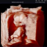 Futuras mamás Abril 2023 (actualizado) - 1