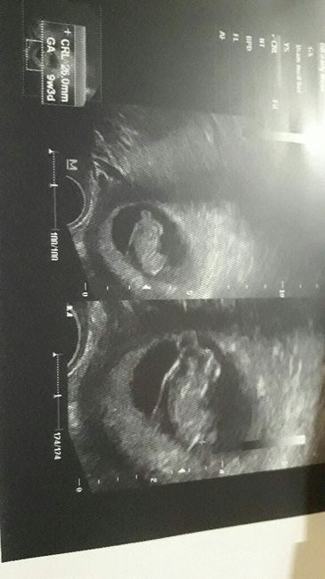 Mamis de junio 2017 - 1