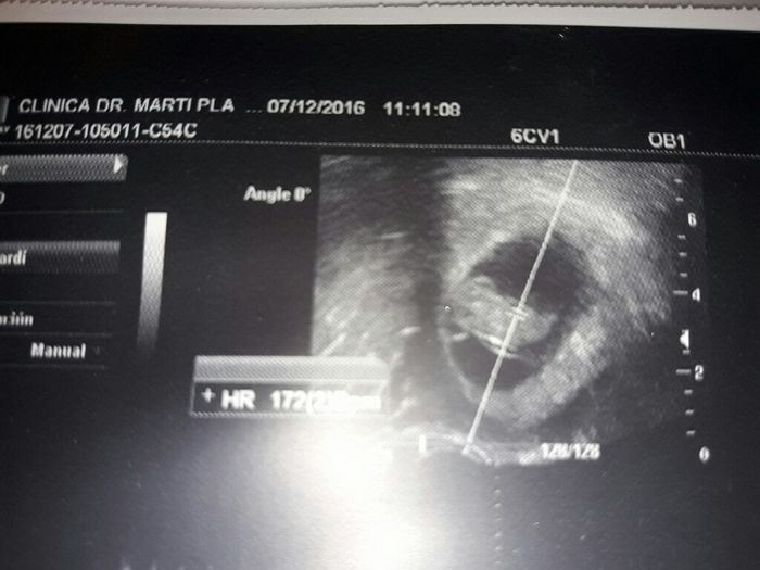 Mamis julio 2017 - 1