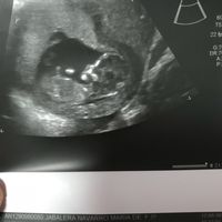 Futuras mamás marzo 2019 - 1