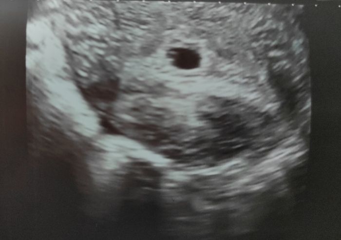 Futuras mamis junio 2021 🤰🏻❤️ oficial - 1