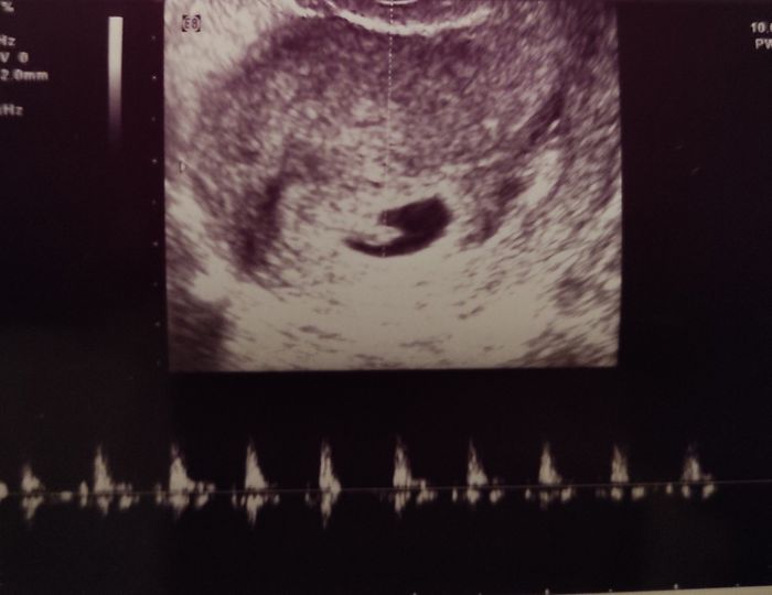 Futuras mamis junio 2021 🤰🏻❤️ oficial - 1