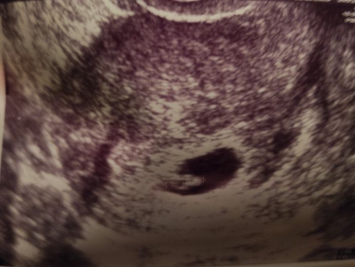 Futuras mamis junio 2021 🤰🏻❤️ oficial - 2