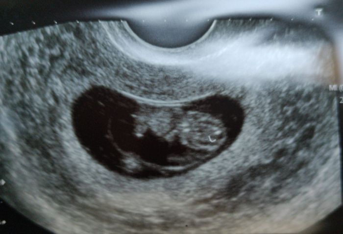 Futuras mamis junio 2021 🤰🏻❤️ oficial - 1