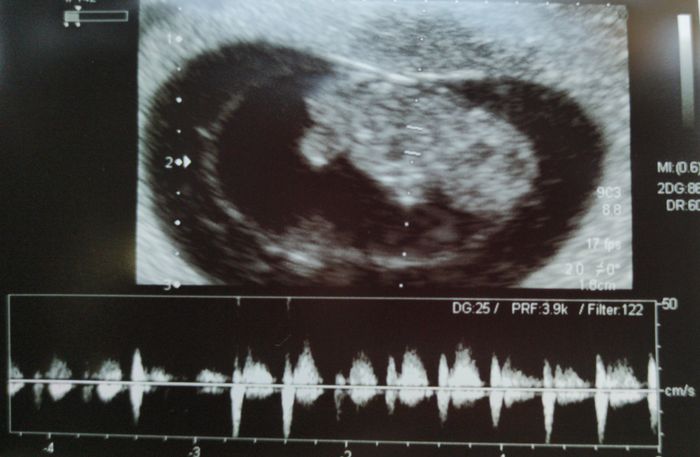 Futuras mamis junio 2021 🤰🏻❤️ oficial - 3