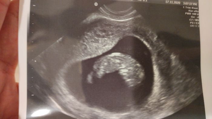 Futuras mamis junio 2021 🤰🏻❤️ oficial - 1