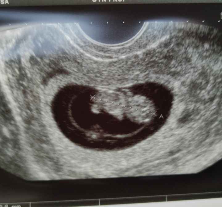 Futuras mamis junio 2021 🤰🏻❤️ oficial 2