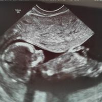 Futuras mamis junio 2021 🤰🏻❤️ oficial - 1