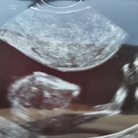 Futuras mamis junio 2021 🤰🏻❤️ oficial - 1