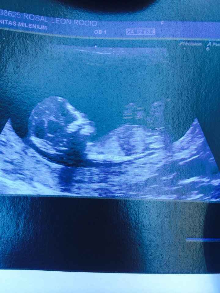 13 semanas 