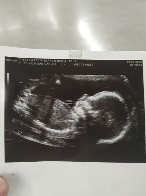 Futuras mamas octubre 2020 - 1