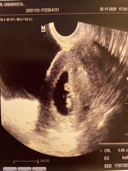 Futuras mamás julio 2021🤰🌹😍😍 1
