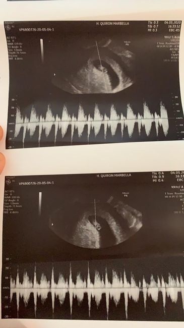 Futuras mamas Diciembre 2020 - 1