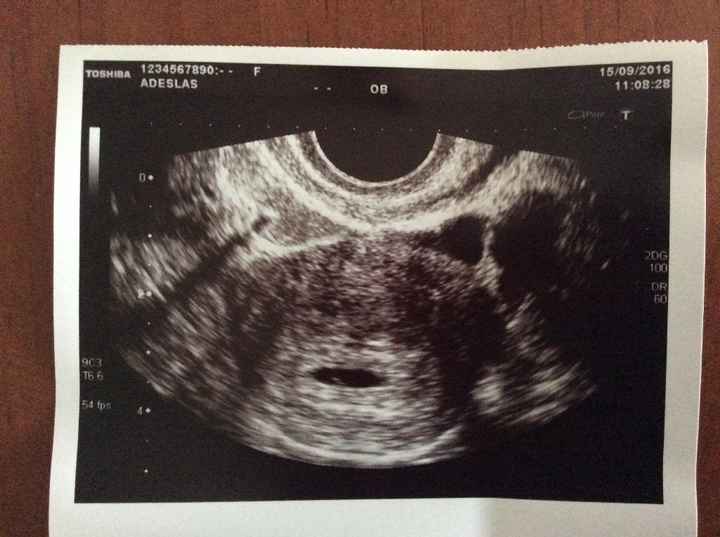 6 semanas 