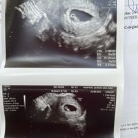 Futuras Mamis Abril 2022 🤰 - 1