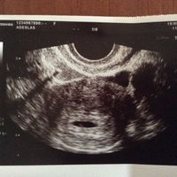 6 semanas 