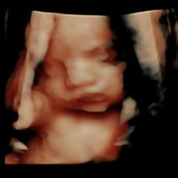 Futuras mamas noviembre 2020 - 1