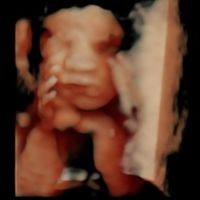 Futuras mamas noviembre 2020 - 3
