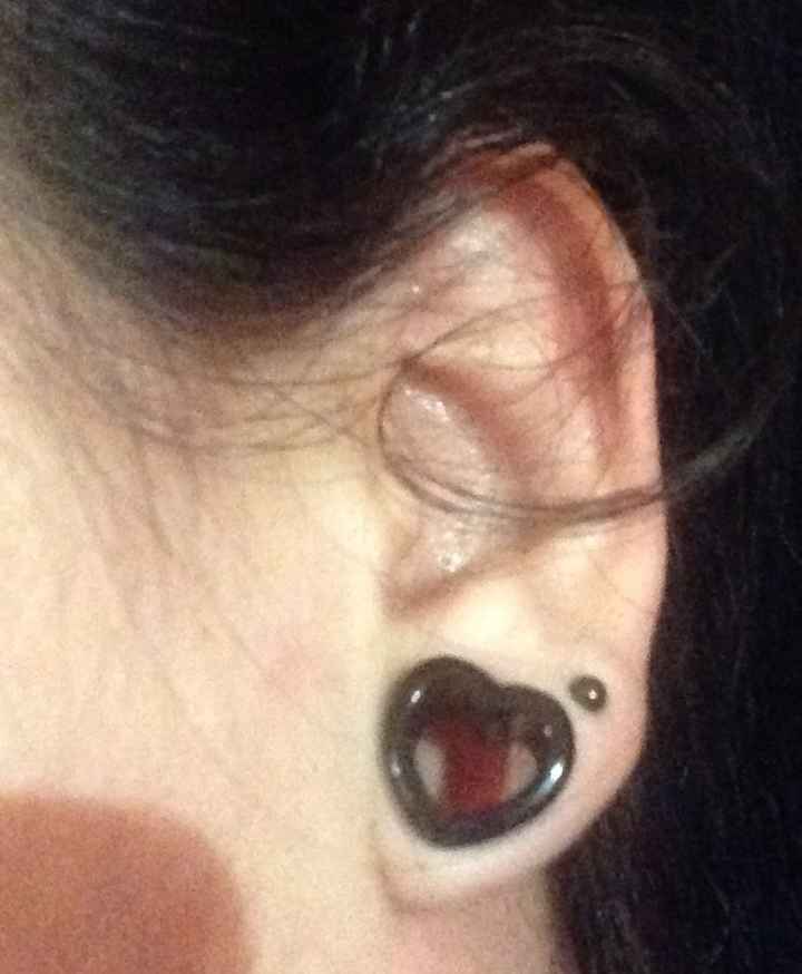 Dilataciones de oreja - 2