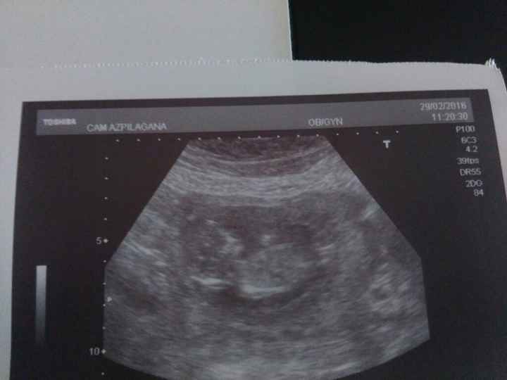 Futuras mamas septiembre 2016 - 1