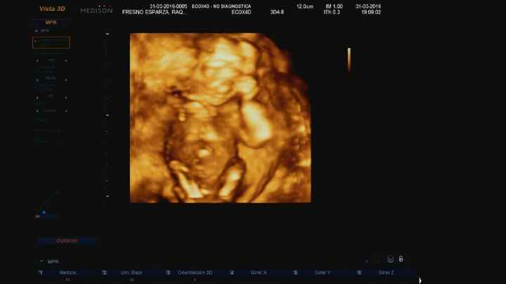 Futuras mamas septiembre 2016 - 2