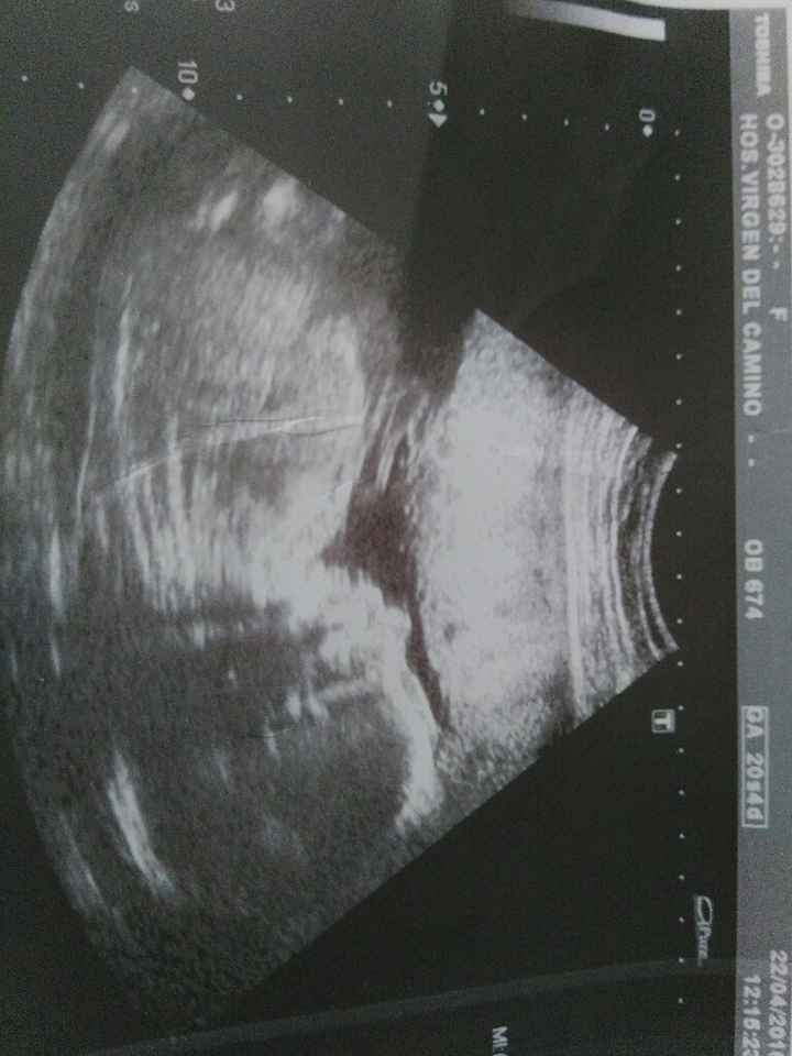 Futuras mamas septiembre 2016 - 1