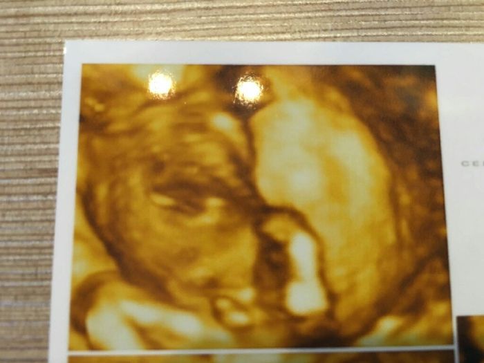 Futuras mamas septiembre 2016 - 3