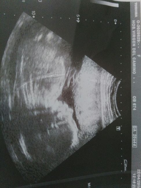 Futuras mamas septiembre 2016 - 1