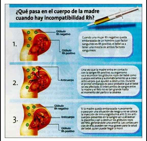 Vacuna embarazo rh negativo - 1