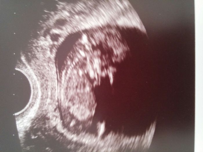 Futuras mamás junio 2016 - 1