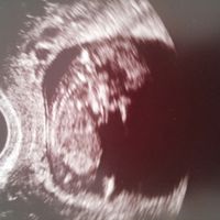 Futuras mamás junio 2016 - 1