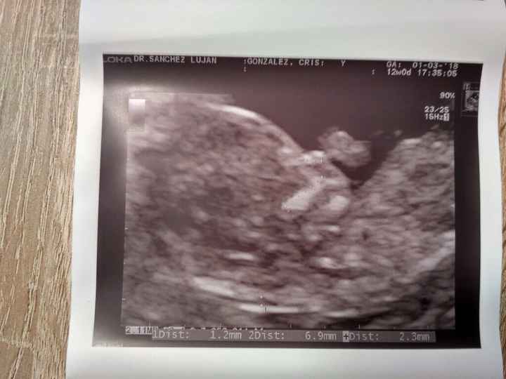 Nuevo! Futuras mamas Septiembre 2018 - 1