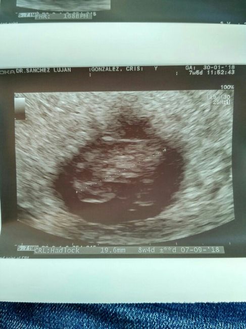  Nuevo! Futuras mamas Septiembre 2018 - 2